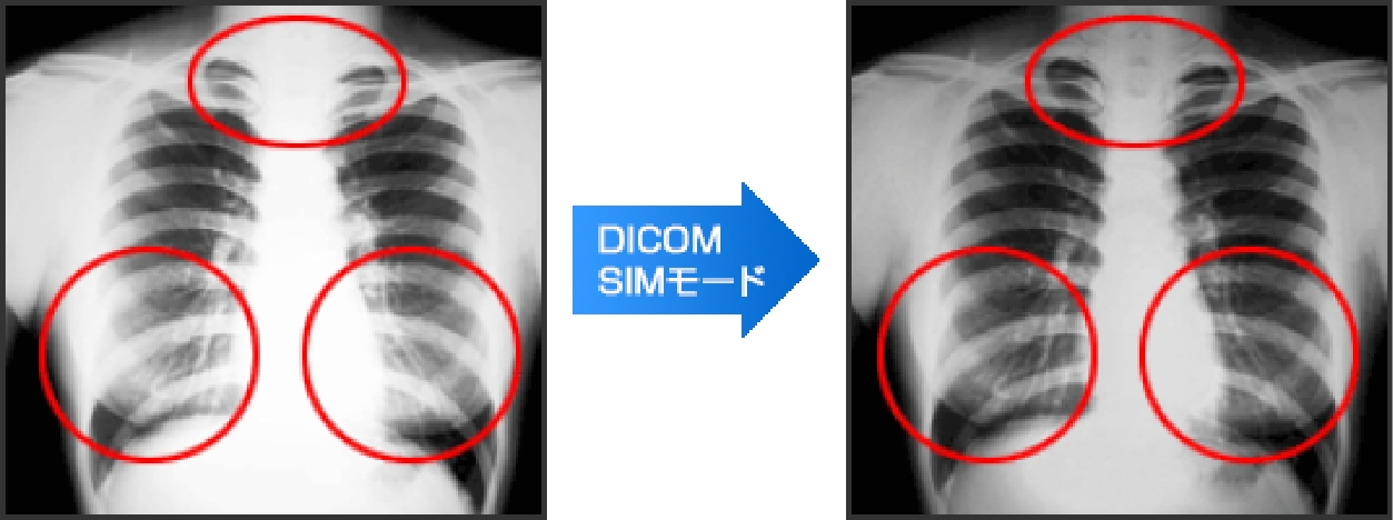 DICOM SIMモード